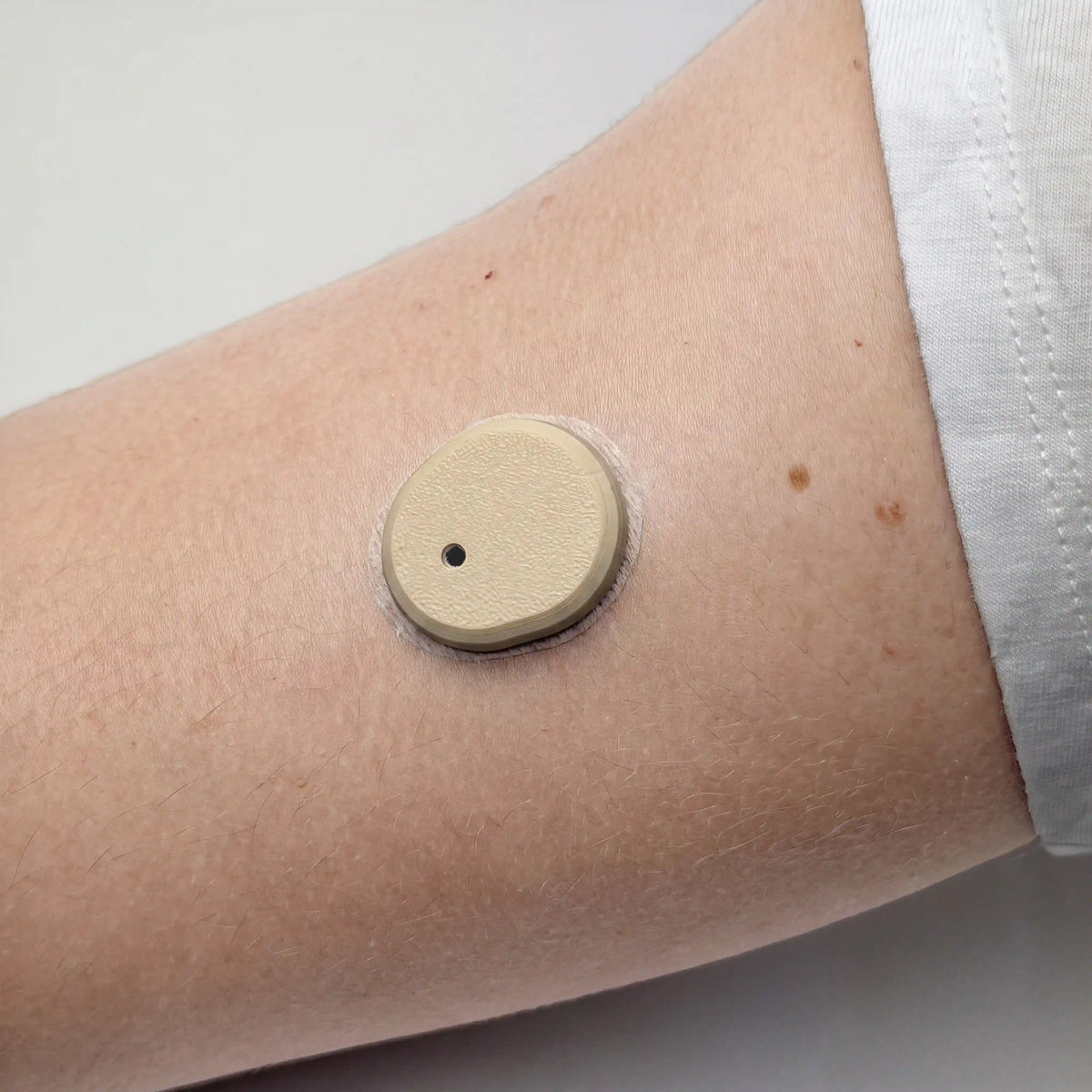 Coque beige clair posée sur un capteur Dexcom G7, portée au bras