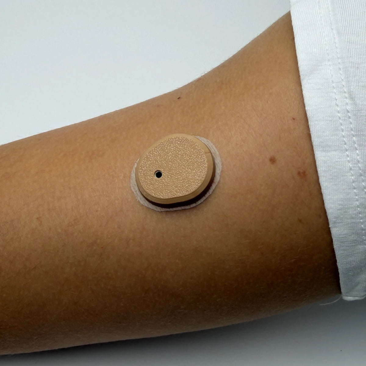 Coque beige foncé posée sur un capteur Dexcom G7, portée au bras