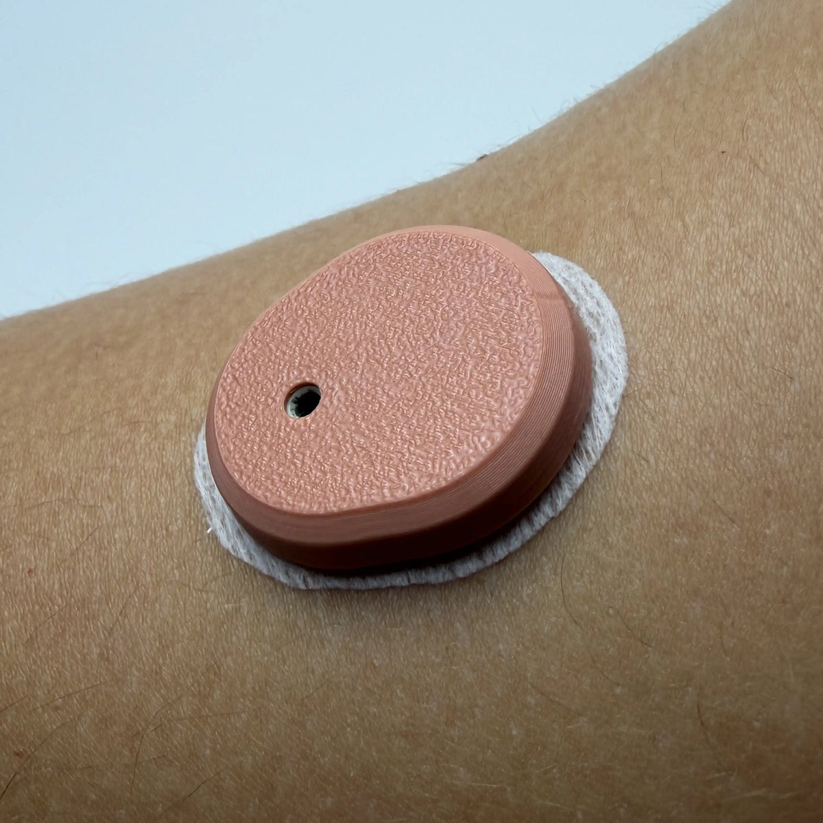 Coque beige rosé sur un capteur Dexcom G7 porté au bras, en gros plan