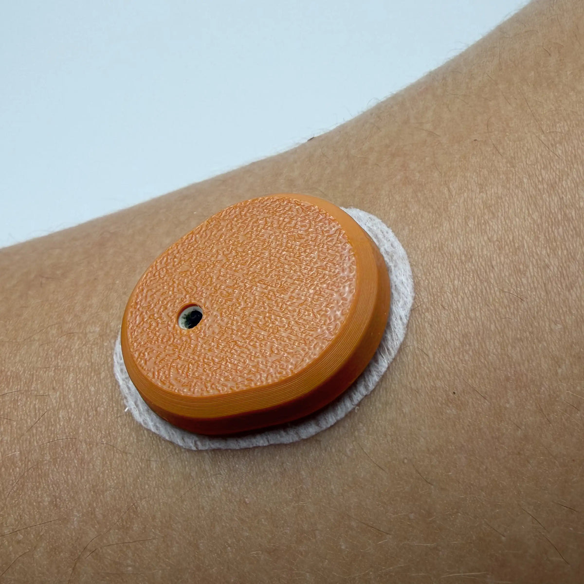 Coque marron clair sur un capteur Dexcom G7 porté au bras, en gros plan