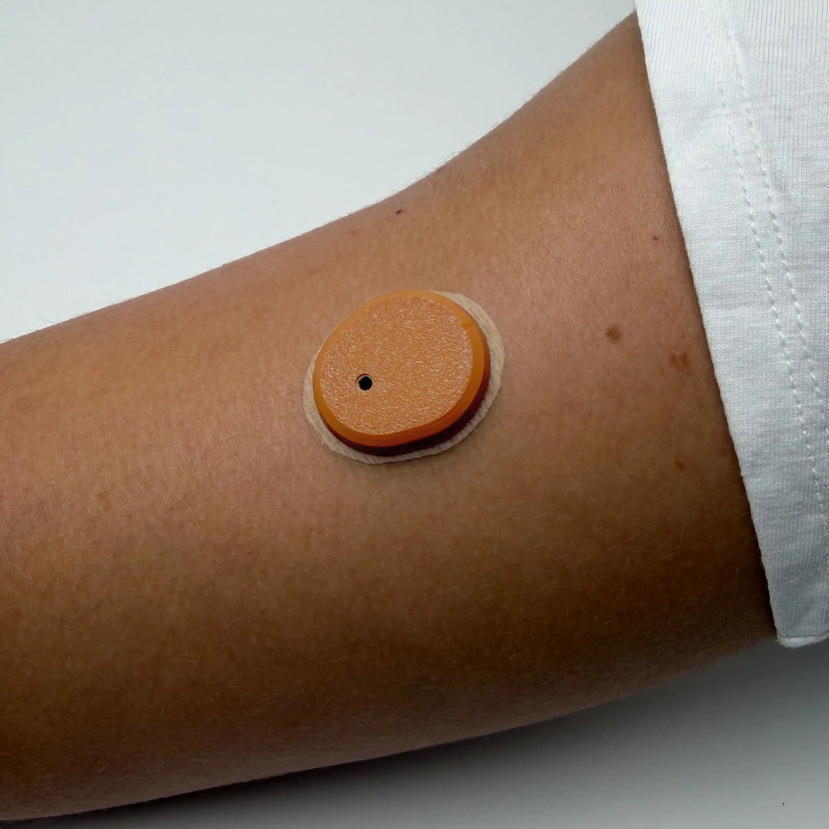 Coque marron clair posée sur un capteur Dexcom G7, portée au bras