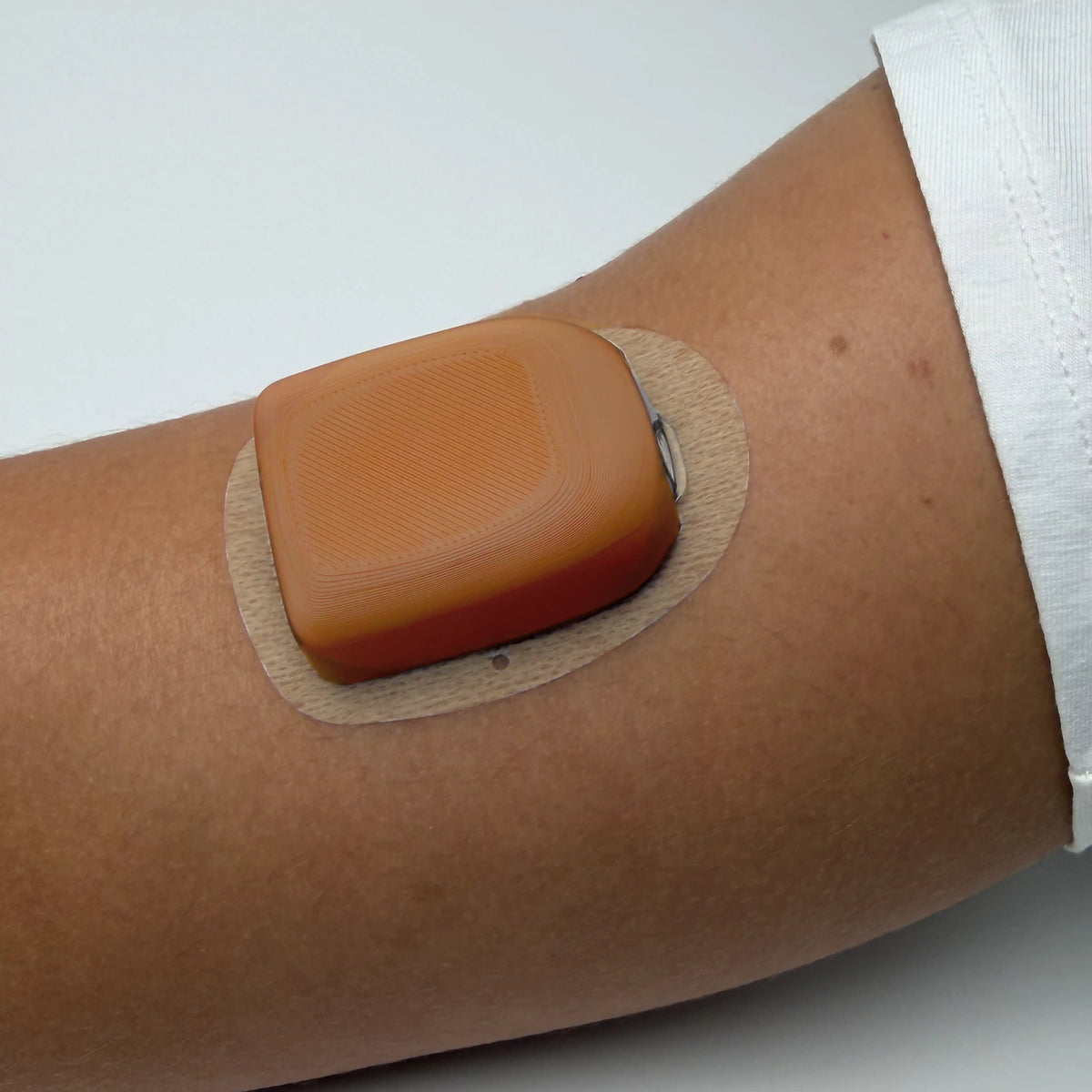 Coque marron clair posée sur un pod Omnipod 5, portée au bras