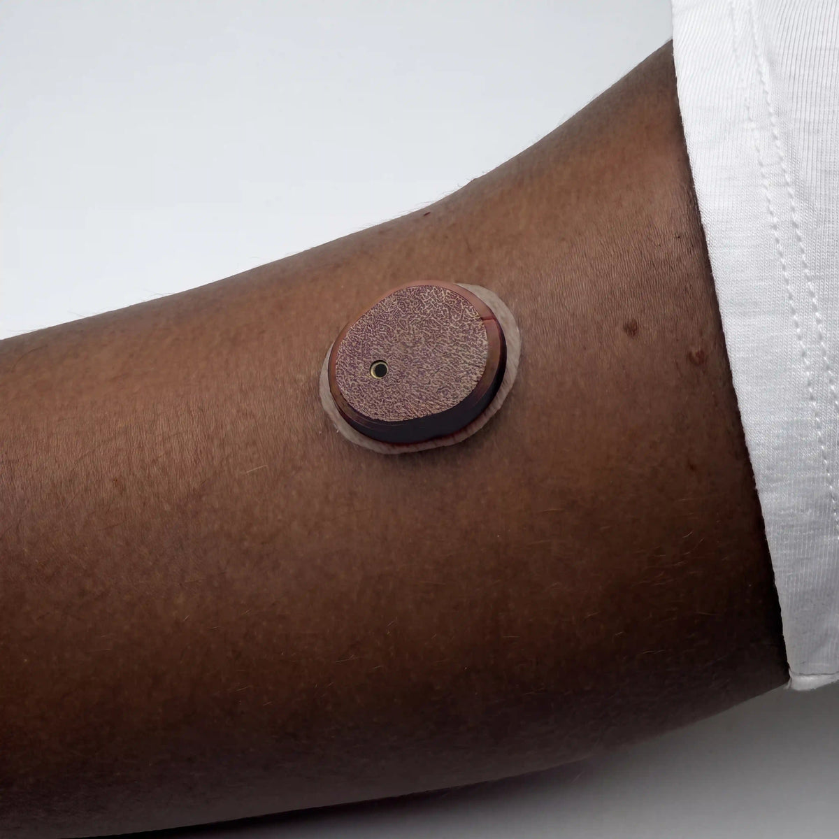 Coque marron ébène posée sur un capteur Dexcom G7, portée au bras