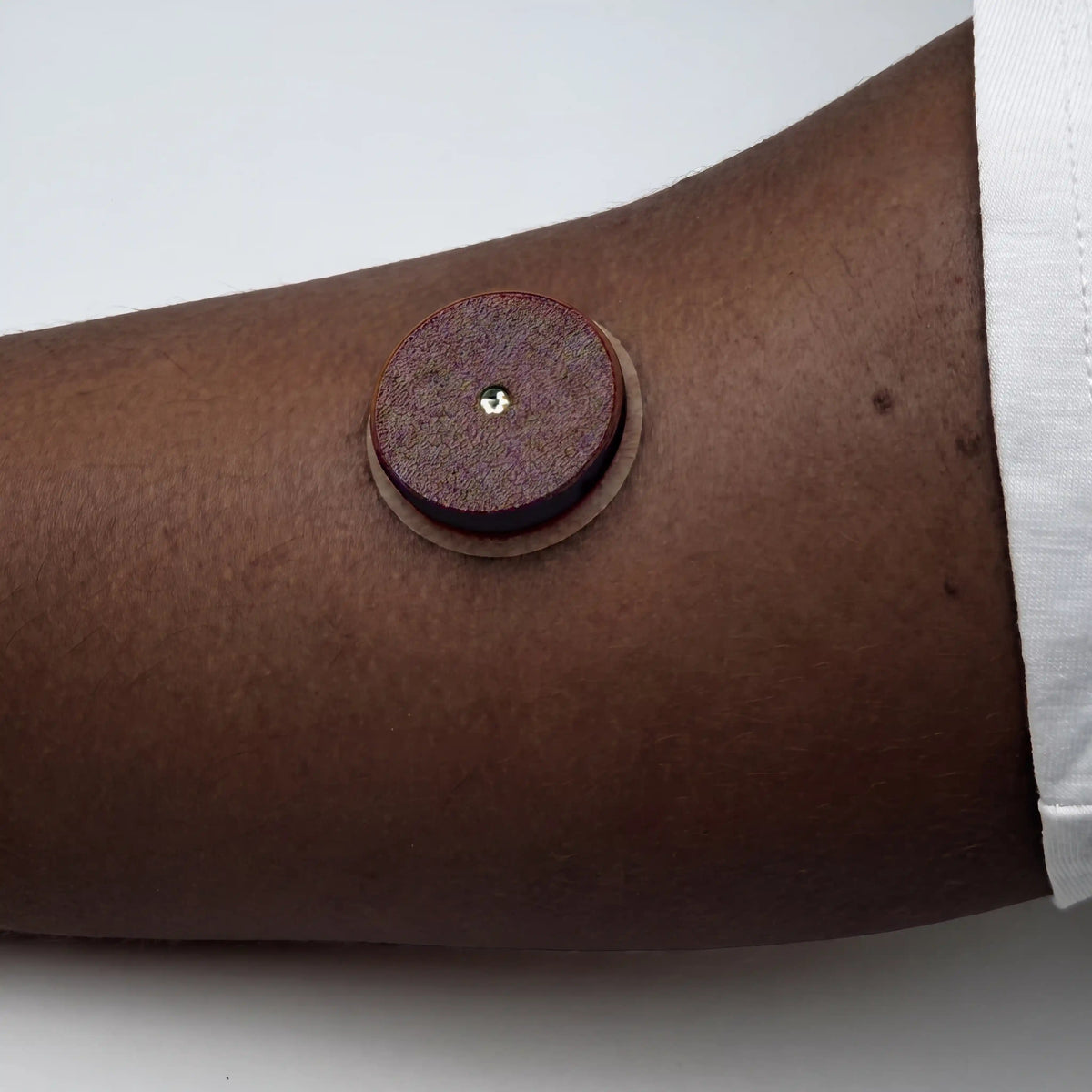 Coque marron ébène posée sur un capteur FreeStyle Libre 2, portée au bras
